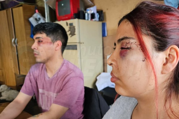 Se entregó el hombre que agredió brutalmente a una joven con una botella