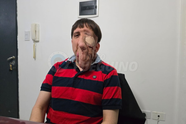 Rubén Monsalve pide ayuda para afrontar la segunda etapa de su cirugía