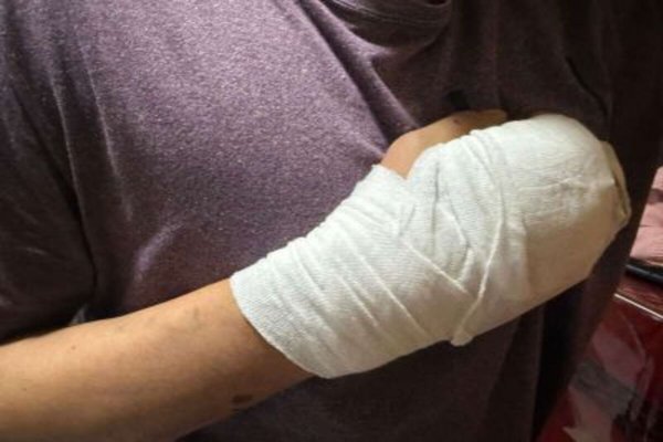 Joven denunció una brutal golpiza, robo y amenazas mientras esperaba un Uber en Río Grande